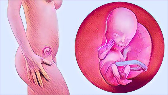 Zimbabwe abortion law reform